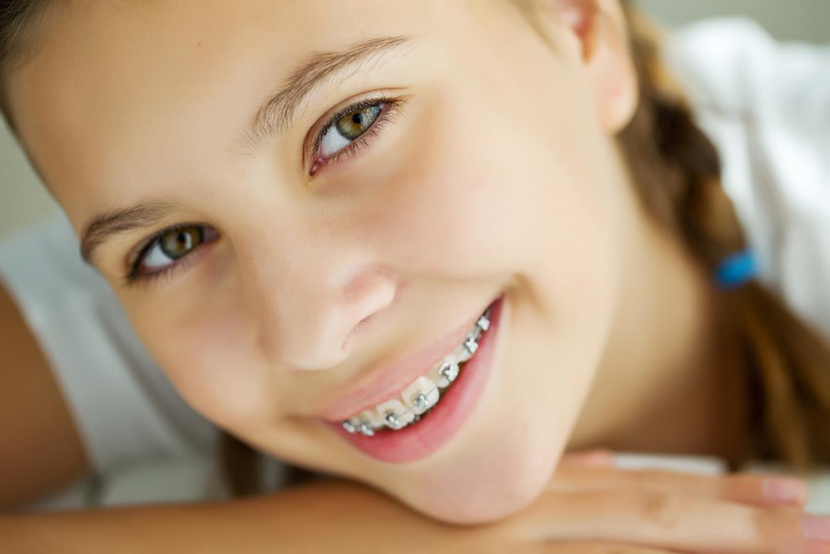 Traditional Braces Burlington, MA